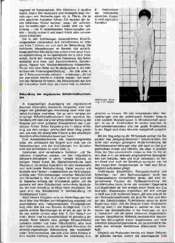 Vorschauseite 3: Anatomie und Therapie des angeborenen Schulterblatthochstandes