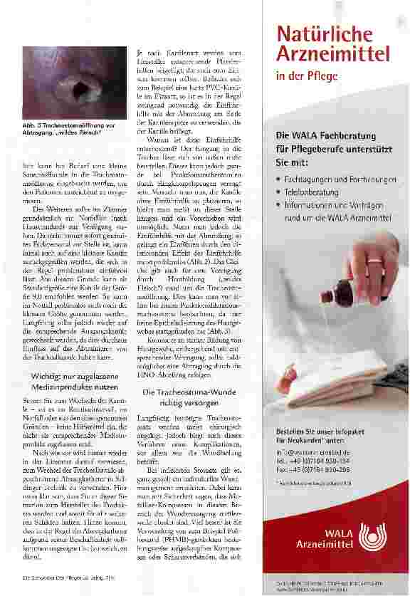 Vorschauseite 4: KEINE ANGST VOR DER FRACHEALKANULE