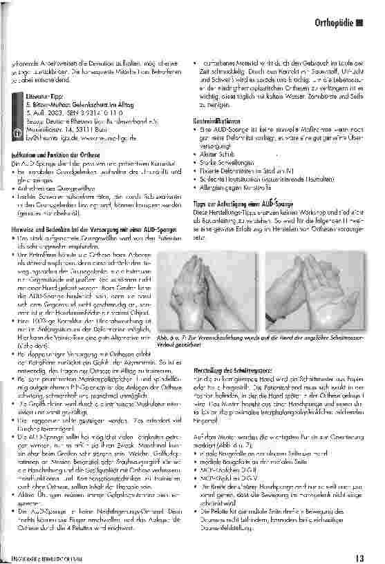 Vorschauseite 3: Die Anti-Ulnar-Drift-Spange (AUD)Hoffnungsträger für viele Patienten und Herausforderung für jeden Therapeuten
