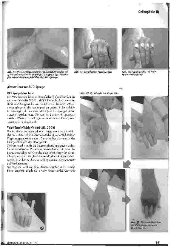 Vorschauseite 5: Die Anti-Ulnar-Drift-Spange (AUD)Hoffnungsträger für viele Patienten und Herausforderung für jeden Therapeuten