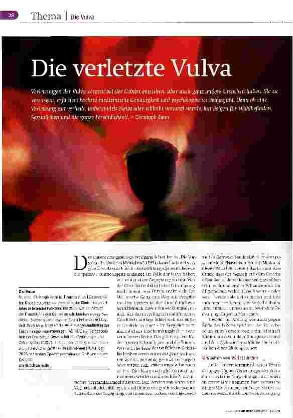 Vorschauseite 1: Die verletzte Vulva