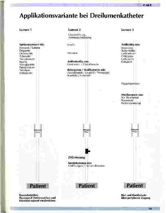 Vorschauseite 5: Erfahrungen mit dem Einsatz von Infusionsfiltern Eine Anleitung für die Praxis