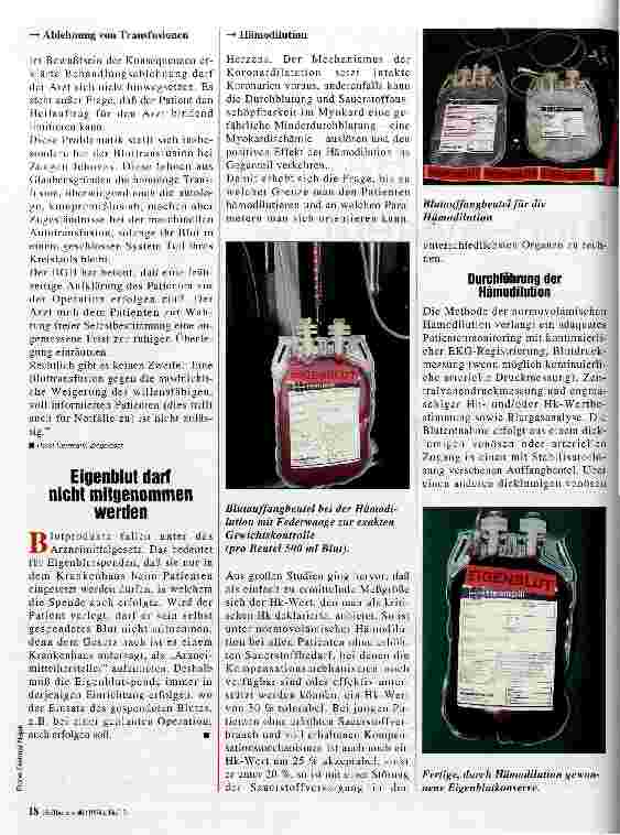 Vorschauseite 2: Hämodilution Verfahren zur Fremdbluteinsparung