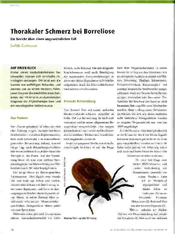 Vorschauseite 1: Thorakaler Schmerz bei Borreliose