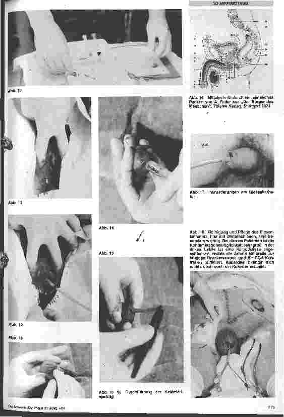 Vorschauseite 4: Grundund Behandlunspflege in der Intensivmedizin 6. Folge: Behandlungspflege bei Blasenkatheter