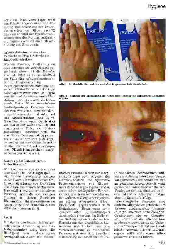 Vorschauseite 2: Allergien gegen Gummihandschuhe