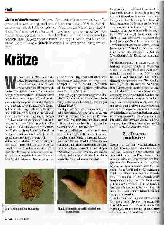 Vorschauseite 1: Krätze Wieder auf dem Vormarsch