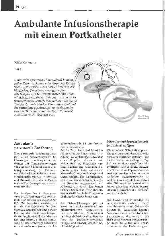 Vorschauseite 1: Ambulante Infusionstherapie mit einem Portkatheter