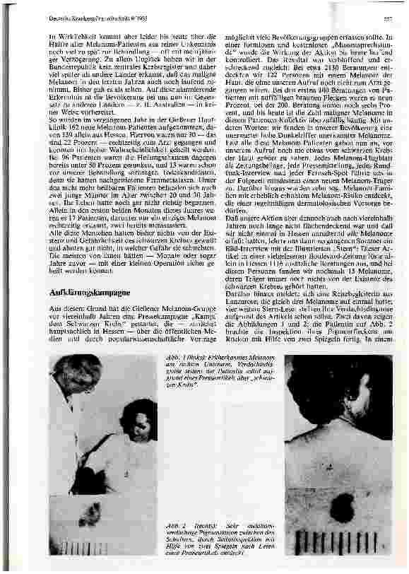Vorschauseite 2: Früherkennung des malignen Melanoms