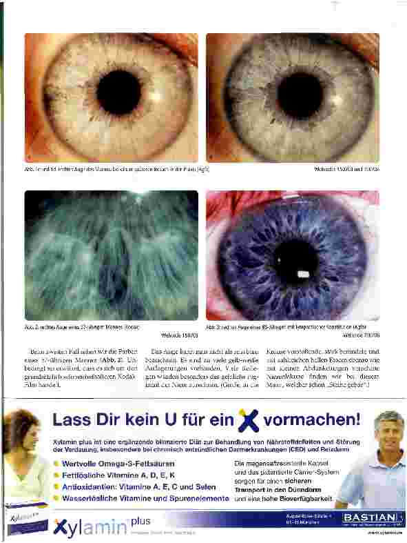 Vorschauseite 2: Irisfotografie Auf der Suche nach dem idealen Blau