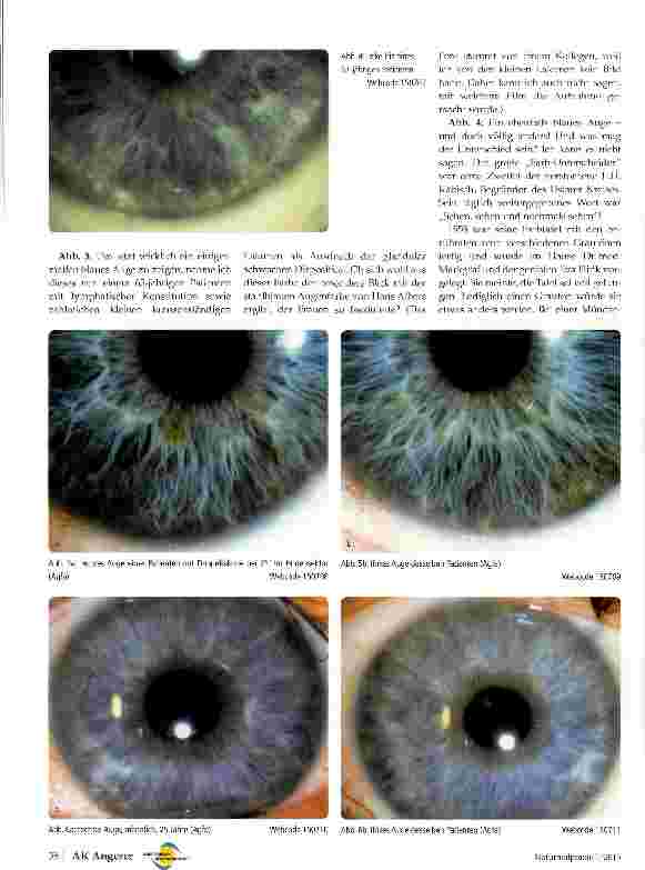 Vorschauseite 3: Irisfotografie Auf der Suche nach dem idealen Blau