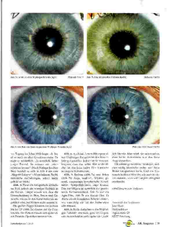 Vorschauseite 4: Irisfotografie Auf der Suche nach dem idealen Blau