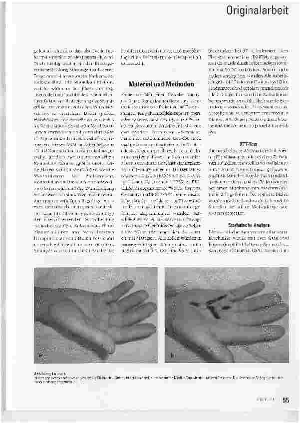 Vorschauseite 2: Stoffwechselkinetik kultivierter humaner Fibroblasten als Indikator der pathologischen Wundheilung - Erste Ergebnisse*