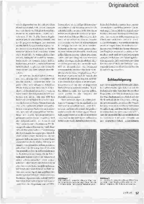 Vorschauseite 4: Stoffwechselkinetik kultivierter humaner Fibroblasten als Indikator der pathologischen Wundheilung - Erste Ergebnisse*