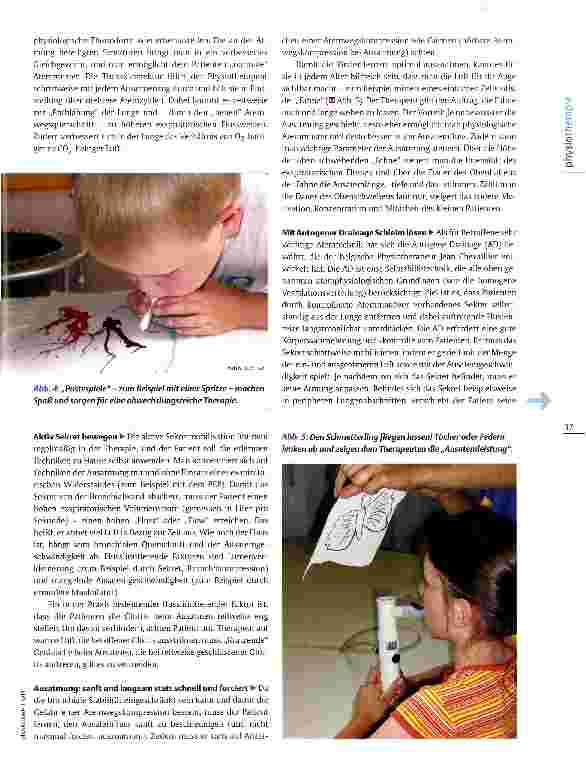 Vorschauseite 4: Physiotherapie bei Mukoviszidose Die Lunge putzen