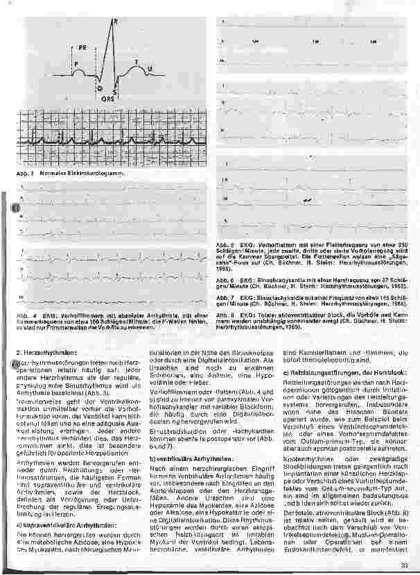 Vorschauseite 2: Das Herz 17. Folge: Postoperative Komplikationen nach Herzoperationen (I. Teil)