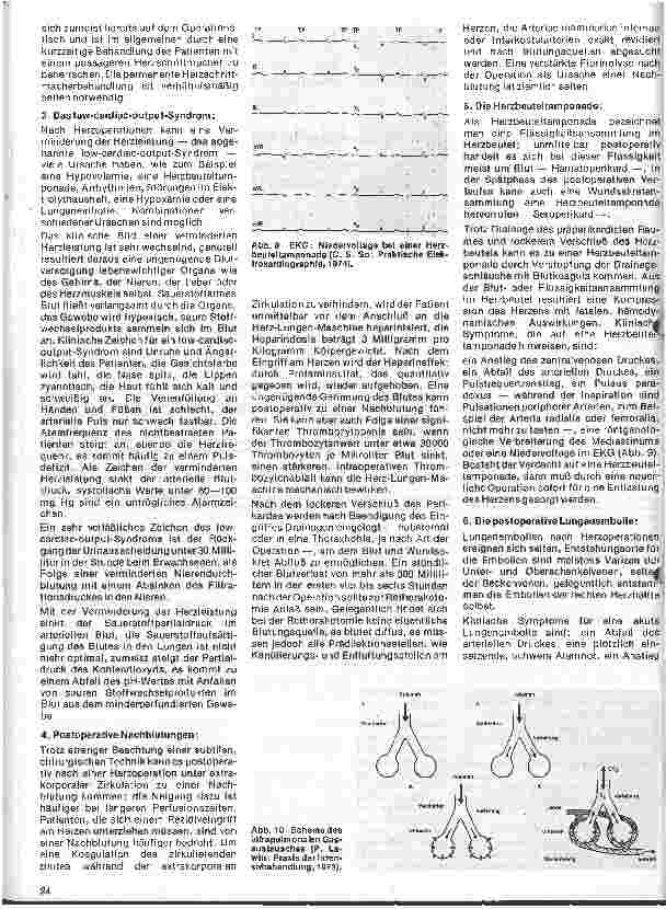 Vorschauseite 3: Das Herz 17. Folge: Postoperative Komplikationen nach Herzoperationen (I. Teil)
