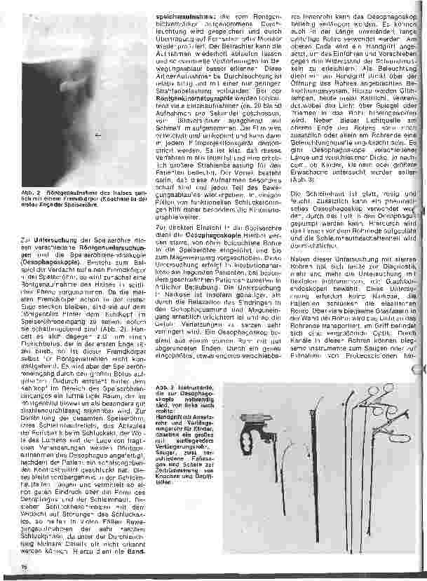 Vorschauseite 2: Einführung in die Hals-Nasen-Ohren-Heilkunde 17. Folge: Die Speiseröhre; Anatomie, Physiologie, Untersuchungsmethoden