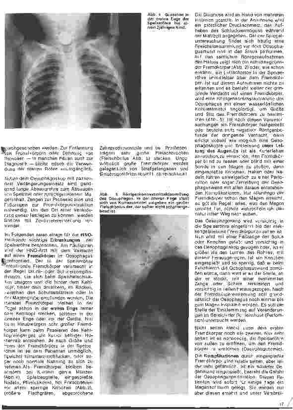 Vorschauseite 3: Einführung in die Hals-Nasen-Ohren-Heilkunde 17. Folge: Die Speiseröhre; Anatomie, Physiologie, Untersuchungsmethoden