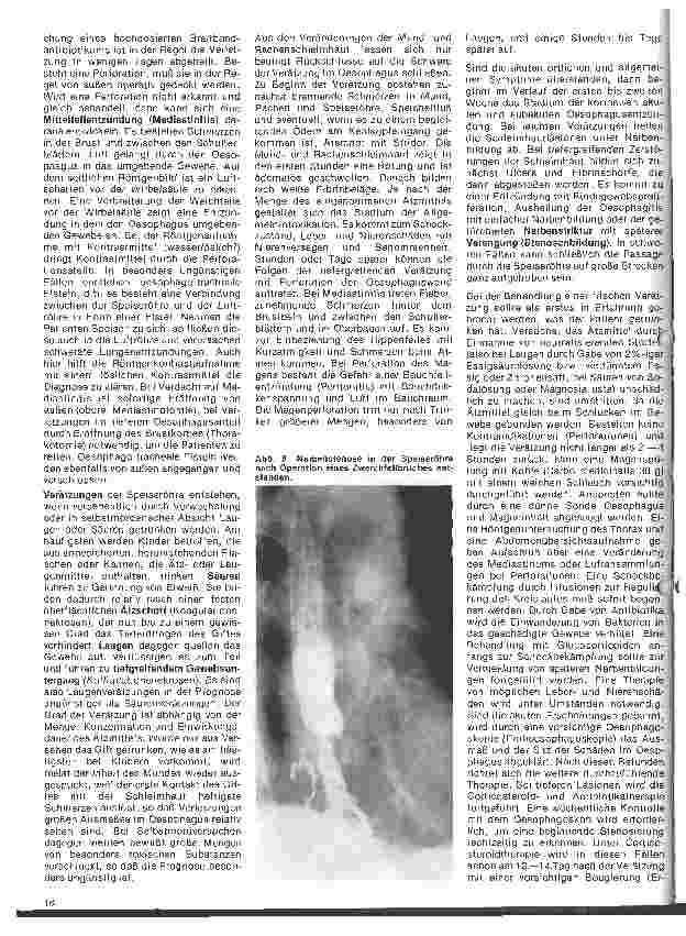 Vorschauseite 4: Einführung in die Hals-Nasen-Ohren-Heilkunde 17. Folge: Die Speiseröhre; Anatomie, Physiologie, Untersuchungsmethoden