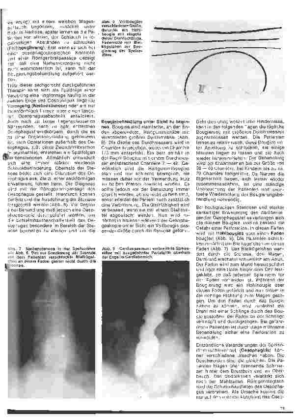 Vorschauseite 5: Einführung in die Hals-Nasen-Ohren-Heilkunde 17. Folge: Die Speiseröhre; Anatomie, Physiologie, Untersuchungsmethoden