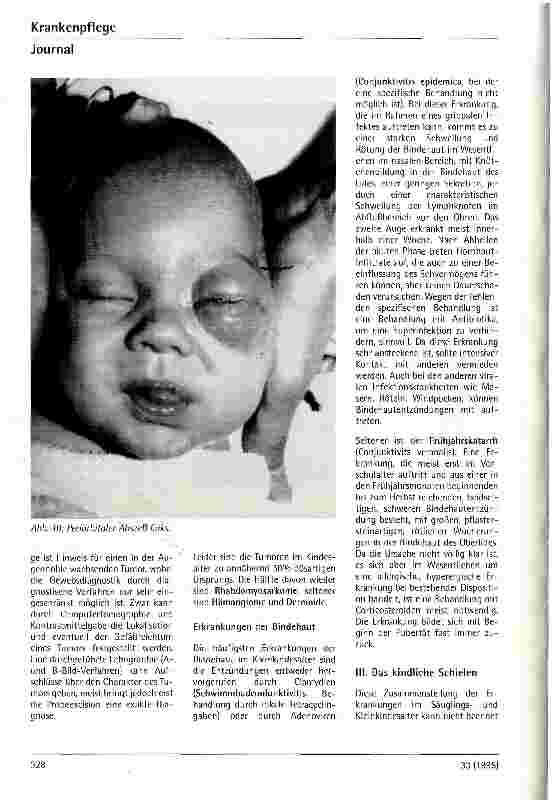 Vorschauseite 4: Augenerkrankungen im Säuglingsund Kleinkindesalter Teil 2