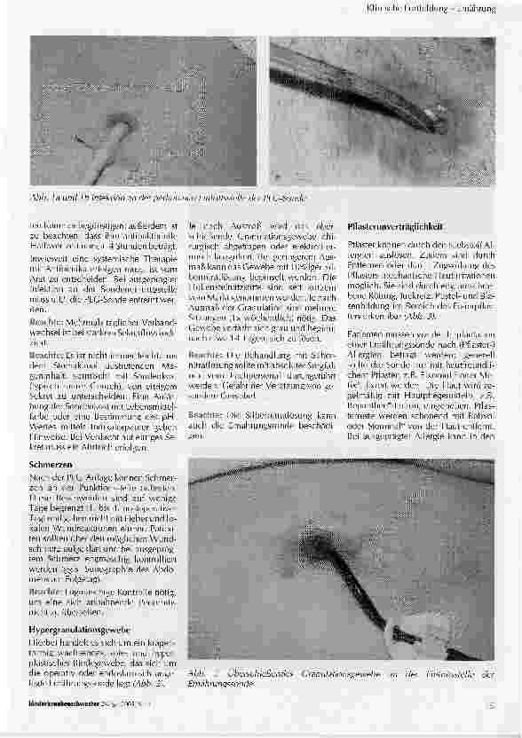 Vorschauseite 2: Praxis der künstlichen enteralen Ernährung in der PädiatrieTeil III: Mögliche Komplikationen