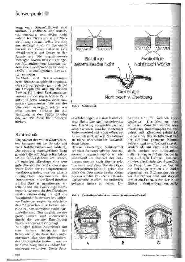 Vorschauseite 4: Stand der Magen-Darm-Chirurgie unter Einsatz gerkömmlicher Techniken aus ärztlicher Sicht