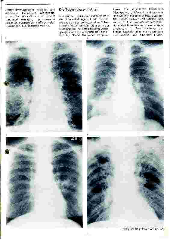 Vorschauseite 2: Die Pneumonie im Alter