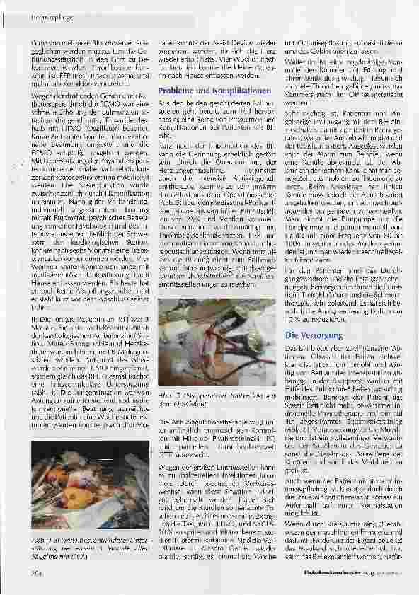 Vorschauseite 2: Berlin HeartExtrakorporale Kreislaufunterstützung in der pädiatrischen Intensivmedizin
