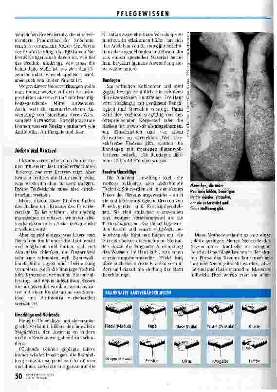 Vorschauseite 3: Damit das Jucken erträglich bleibt Handhabung und Therapie von Ekzemen