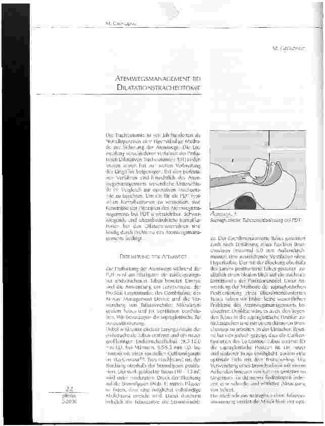 Vorschauseite 1: ATEMWEGSMANAGEMENT BEI DLLATATIONSTRACHEOTOMIE