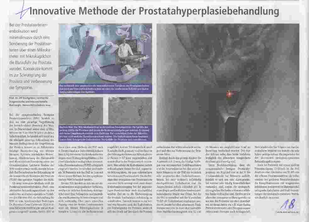 Vorschauseite 1: Innovative Methode der Prostatahyperplasiebehandlung