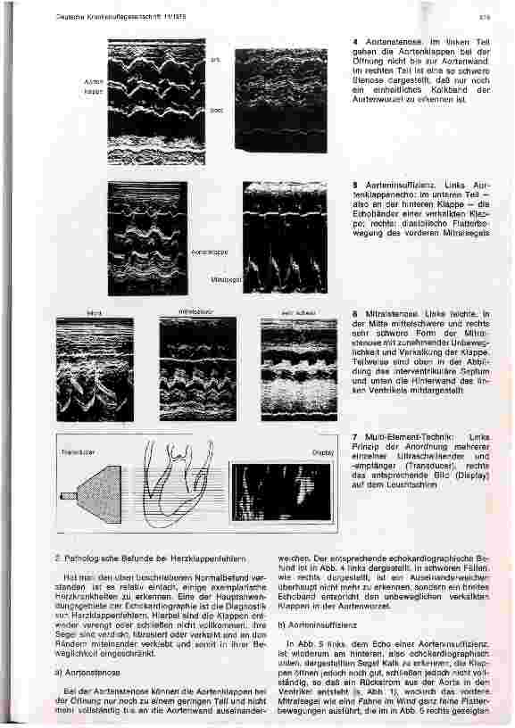 Vorschauseite 3: Echokardiographie