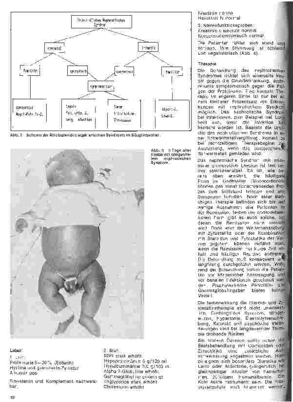 Vorschauseite 3: Kinderheilkunde Vererbte Krankheiten // 8. Folge: Das nephrotische Syndrom