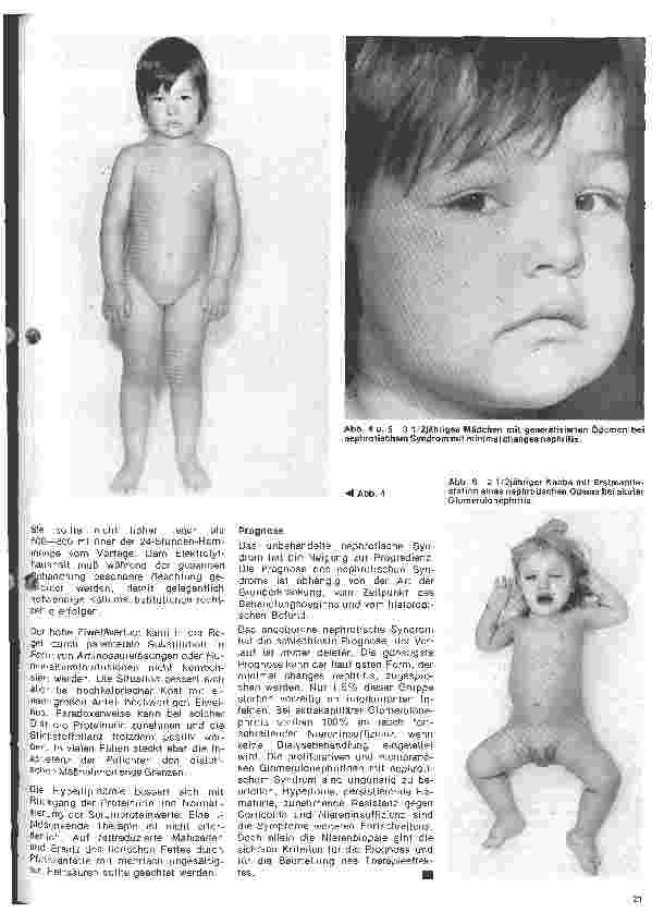 Vorschauseite 4: Kinderheilkunde Vererbte Krankheiten // 8. Folge: Das nephrotische Syndrom