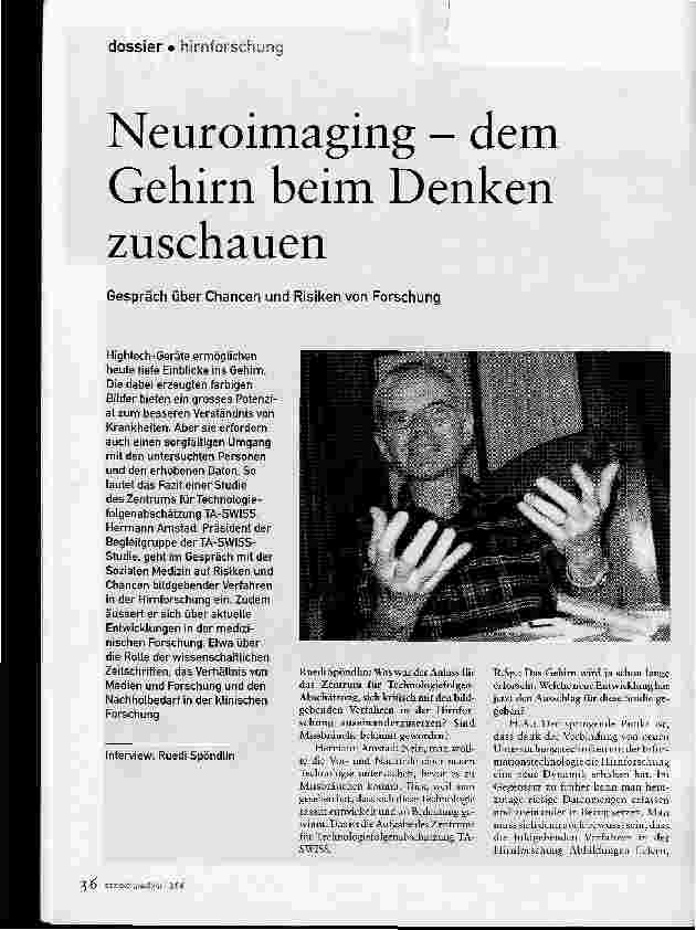 Vorschauseite 1: Neuroimaging - dem Gehirn beim Denken zuschauen
