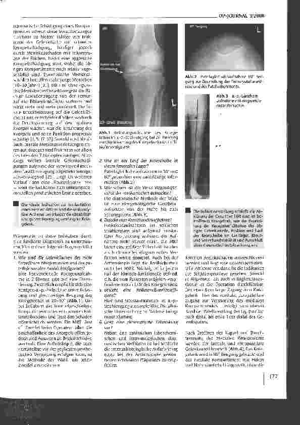 Vorschauseite 2: Posttraumatische unikondyläre Knieendoprothetik