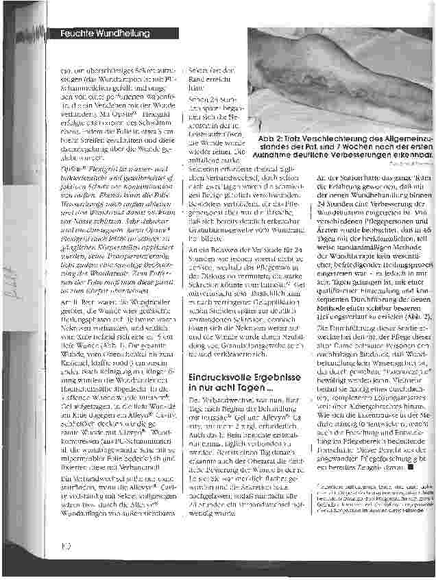 Vorschauseite 3: Effiziente Versorgung chronischer Wunden durch feuchte Wundbehandlung