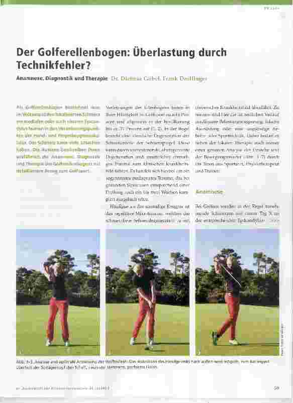 Vorschauseite 1: Der Golferellenbogen: Überlastung durch Technikfehler?