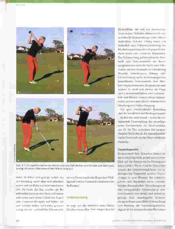 Vorschauseite 2: Der Golferellenbogen: Überlastung durch Technikfehler?