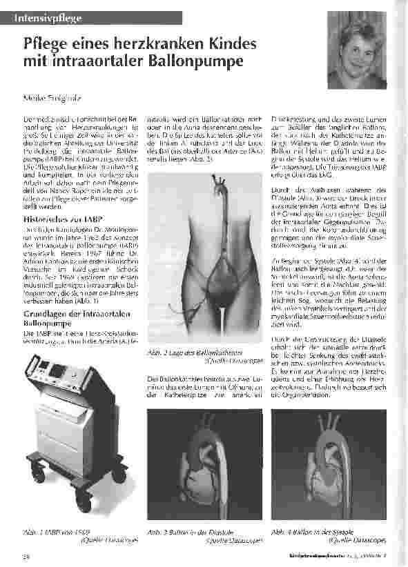 Vorschauseite 1: Pflege eines herzkranken Kindes mit intraaortaler Ballonpumpe