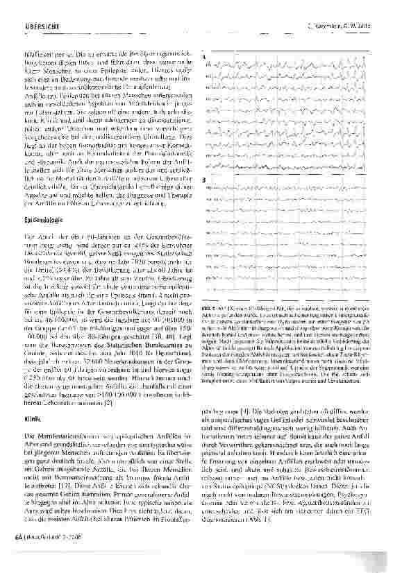 Vorschauseite 2: Differentialdiagnose und Therapie der Epilepsie im Alter