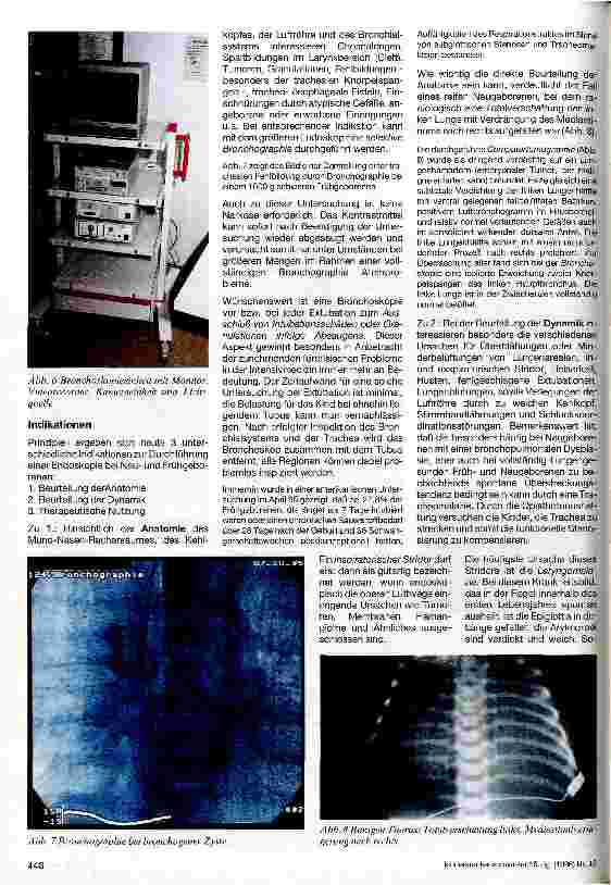 Vorschauseite 3: Flexible Bronchoskopie bei Neuund Frühgeborenen