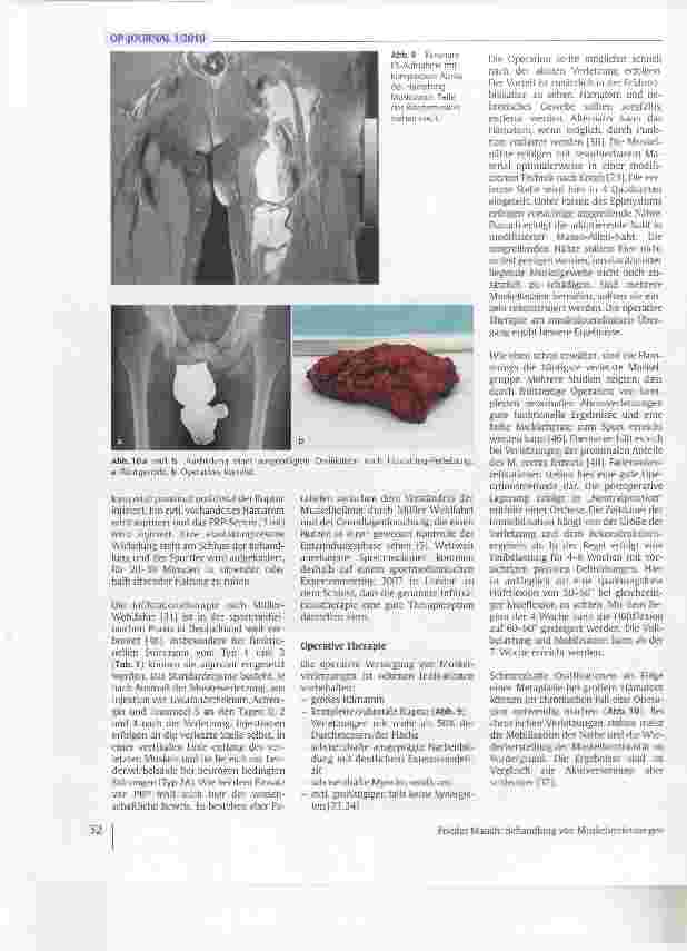 Vorschauseite 6: Behandlung von Muskelverletzungen