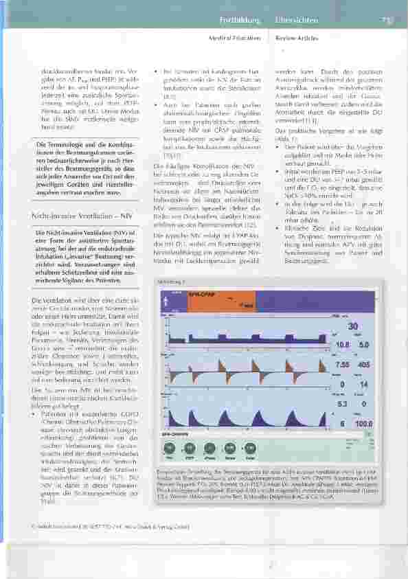 Vorschauseite 4: Beatmung des Intensivpatienten eine Praxisanleitung