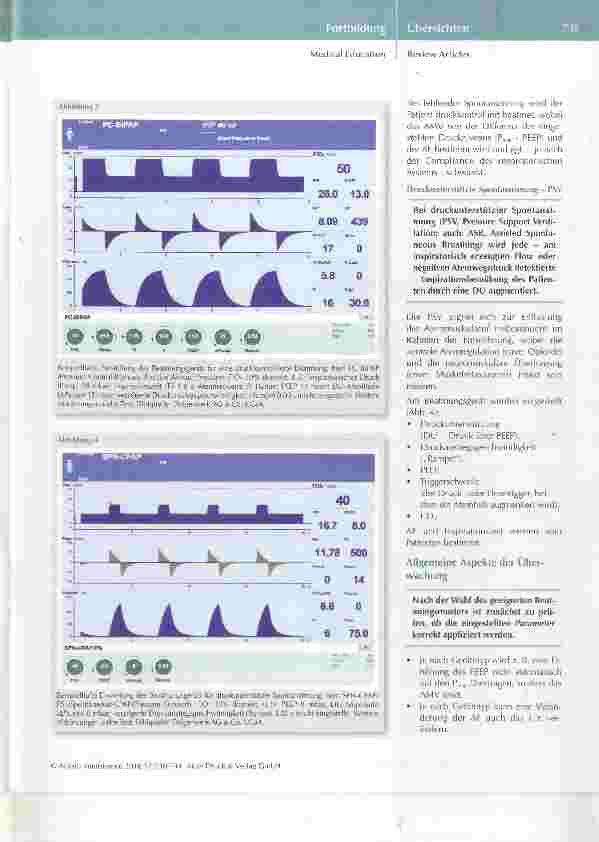 Vorschauseite 6: Beatmung des Intensivpatienten eine Praxisanleitung