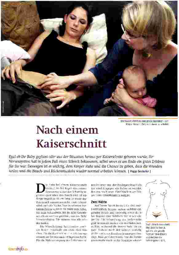 Vorschauseite 1: Nach einem Kaiserschnitt