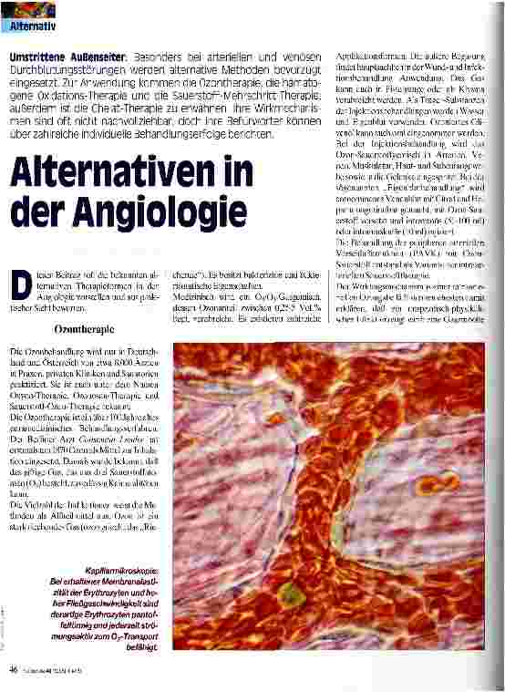 Vorschauseite 1: Alternativen in der Angiologie