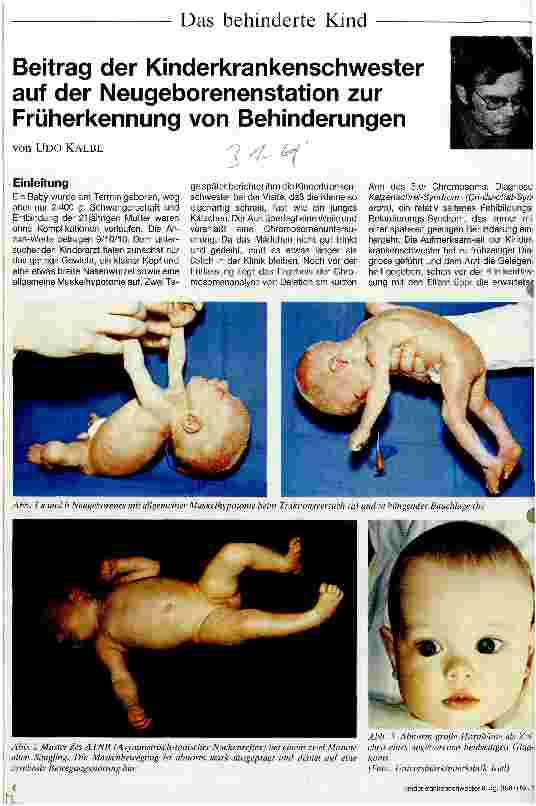 Vorschauseite 1: Beitrag der Kinderkrankenschwester auf der Neugeborenenstation zur Früherkennung von Behinderungen